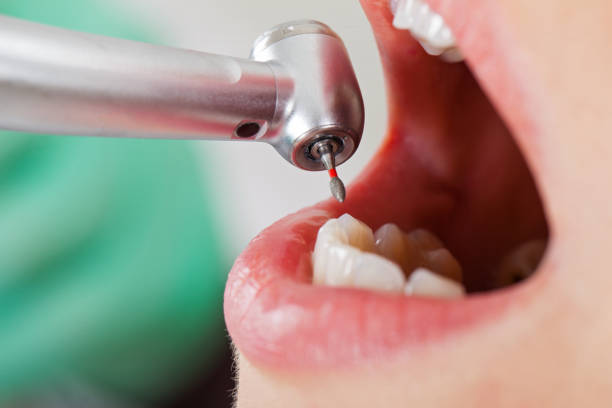 Best Emergency Dental Surgery in Elkton, VA